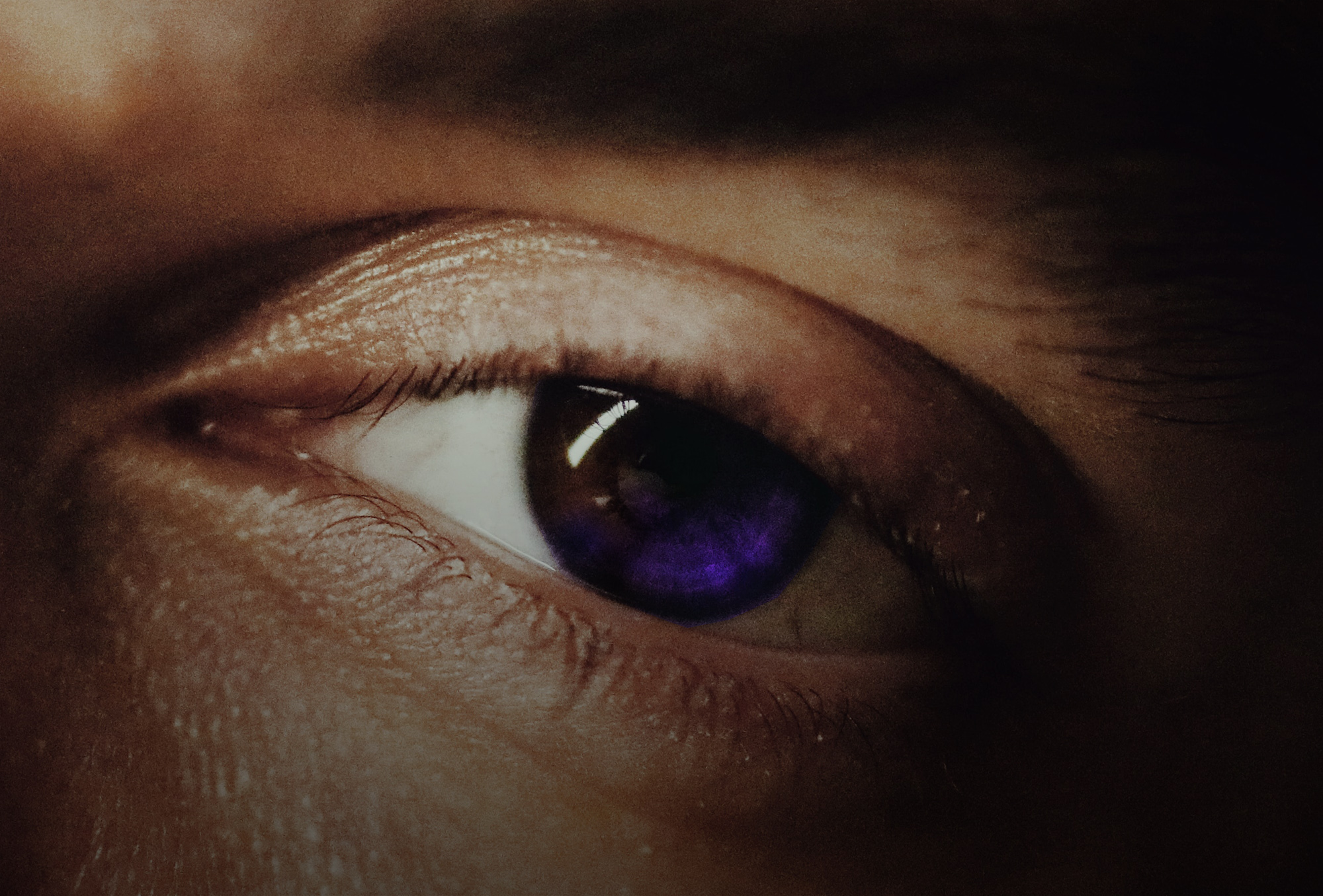 Eye with brown and purple iris