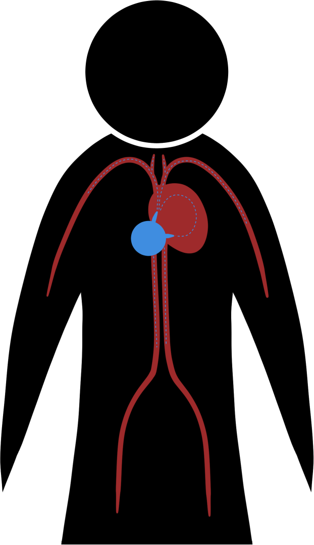 Simple black silhouette of a person with a red shape representing the heart, and a small blue circle attached to the heart representing the Celestial Core.